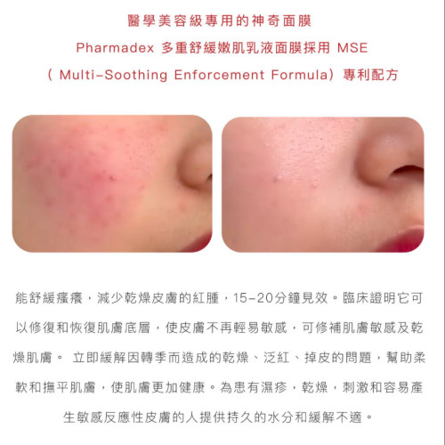 PHARMADEX MSE INSTANT退紅神奇面膜